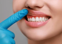Why Early Gum Disease Treatment Is Essential for Long-Term Oral Healths
